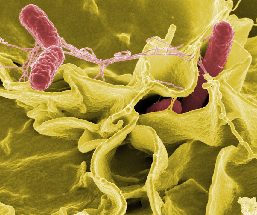 Lebensmittelinfektionen: Bakterien wie Salmonellen und Campylobacter haben jetzt Hochsaison